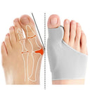 Monture® - Bunion Corrector - Monture Footwear